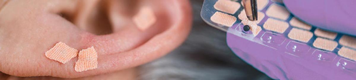 Auriculoterapia em Vinhedo